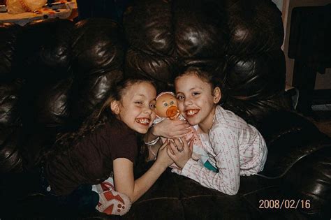 gabby garcia conjoined twin|Former conjoined twin recalls sisters death at age 13